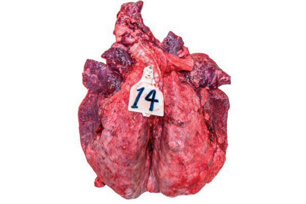 БРСВ не просто повреждает клетки лёгких, он вызывает сильное воспаление во всех лёгких